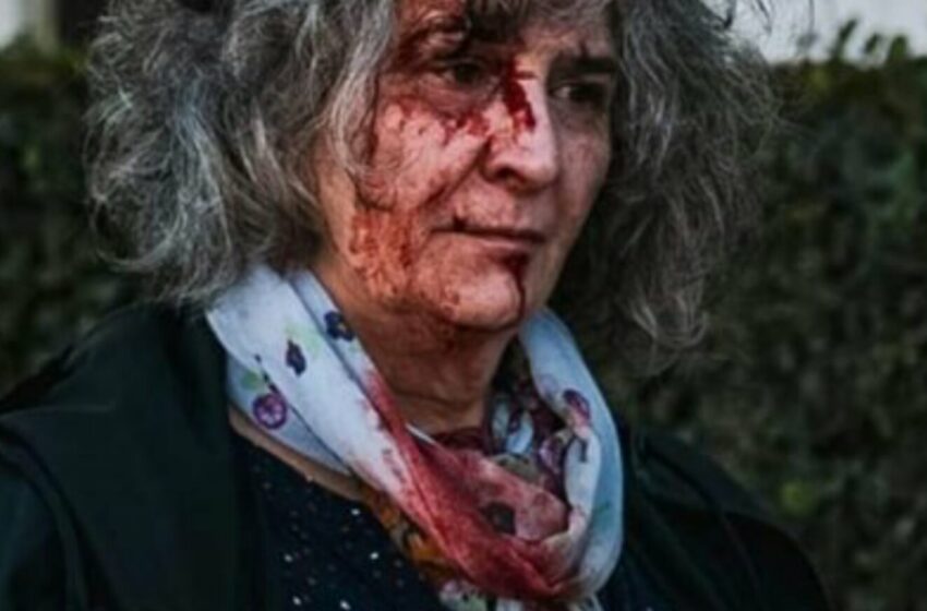  Επίθεση και τραυματισμό γυναίκας εκπαιδευτικού από τα ΜΑΤ καταγγέλλει ο Σ.Ε.Π.Ε. “Γ.Σεφέρης”